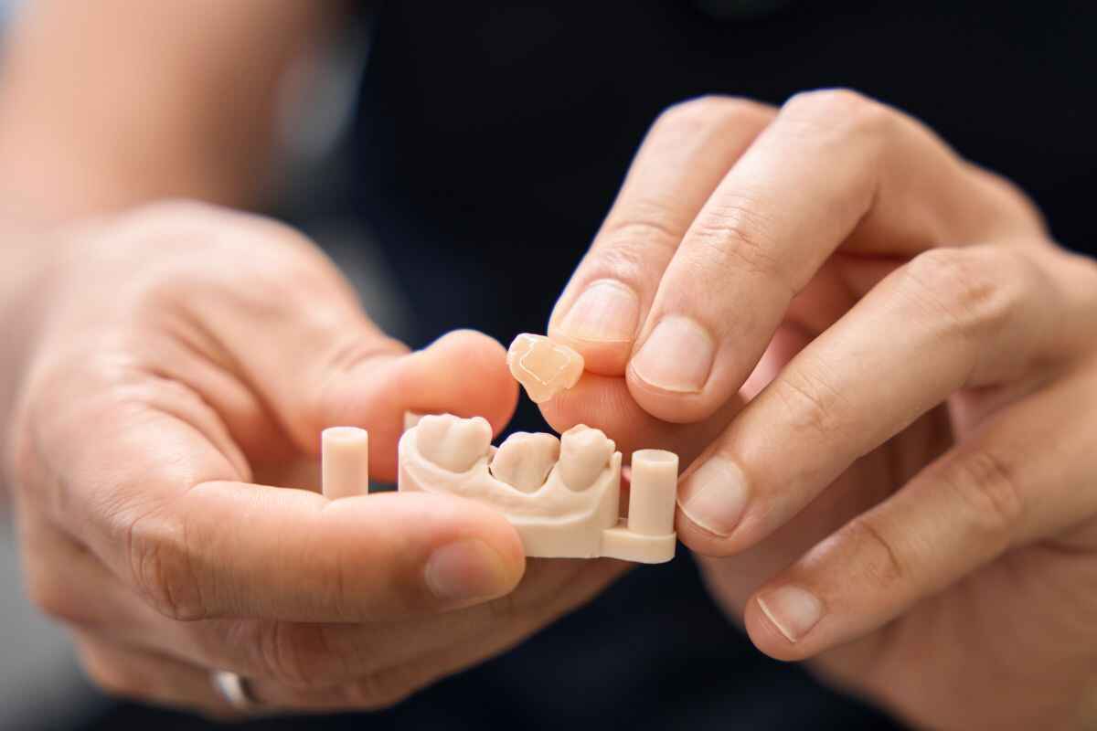 Hands holding a dental model and carefully placing a porcelain crown or veneer onto a prepared tooth.